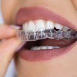 dental-patient-wearing-invisalign